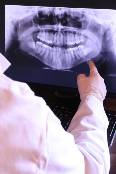 Best Emergency Broken Tooth Repair in Burton, OH