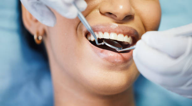 Best Emergency Tooth Extraction in Burton, OH